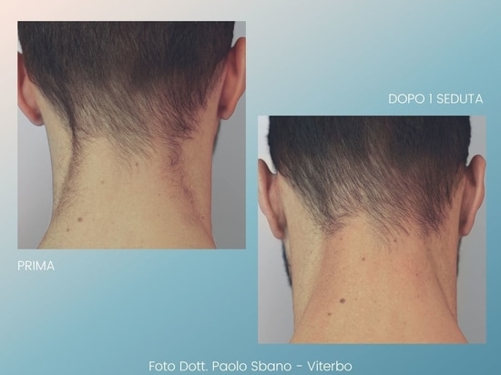Prima e Dopo