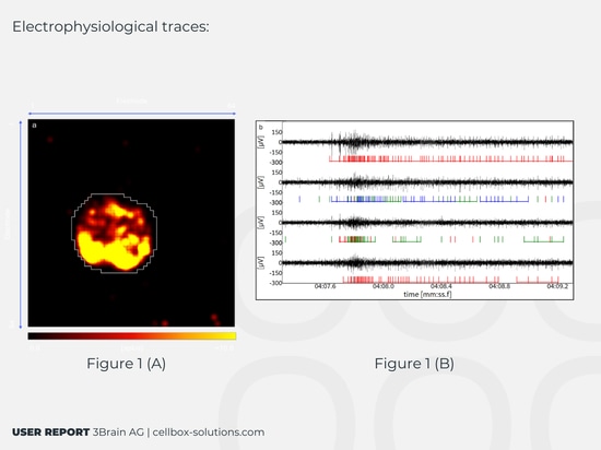 Tracce elettrofisiologiche: