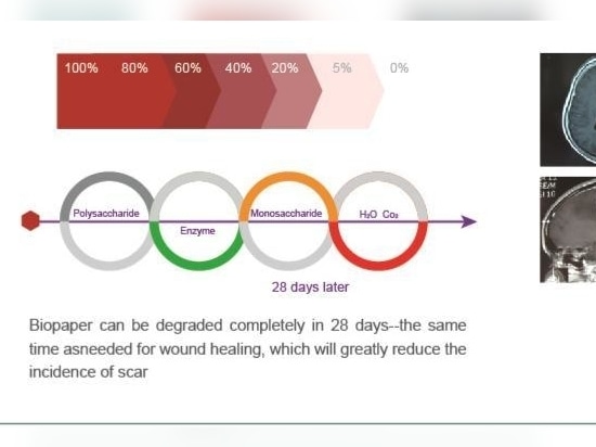Biopaper ® è un nuovo tipo di materiale emostatico biodegradabile brevettato.