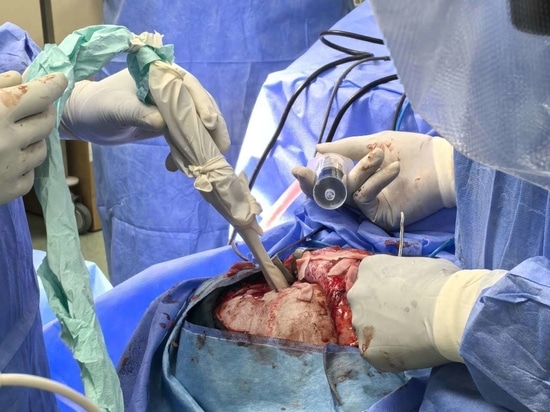 NPUS-01: Il dispositivo a ultrasuoni portatile progettato per la neurochirurgia