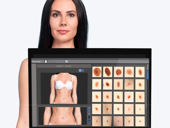 Ridurre i tempi di attesa con il BodyMapper E4