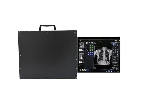DR portatile: raddoppia l'efficienza dell'esame fisico e i suoi vantaggi fondamentali