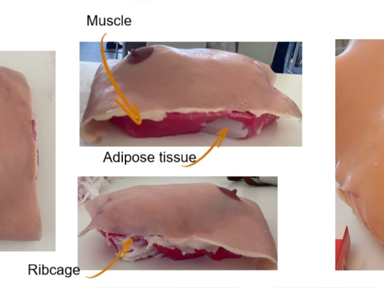 3D Innovation Lab presenta un nuovo fantoccio mammario stampato in 3D su misura per il paziente, progettato per migliorare la formazione in chirurgia oncoplastica: un’innovazione rivoluzionaria rec...
