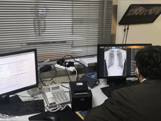 L'ospedale Sir Run Run Shaw, affiliato alla Zhejiang University School of Medicine, ha introdotto il DR a doppia colonna della serie Mednova Staray.