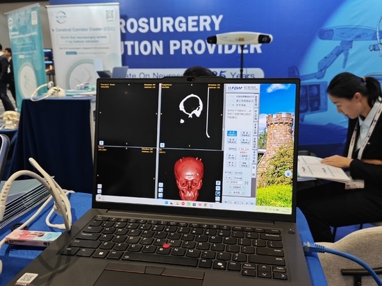 HUIDAMED AACNS 2026 a Manila: promuovere l'innovazione nella neurochirurgia