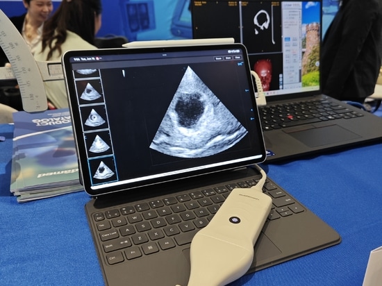 HUIDAMED AACNS 2026 a Manila: promuovere l'innovazione nella neurochirurgia