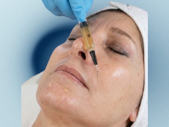 REVYPEEL Il peeling ibrido
