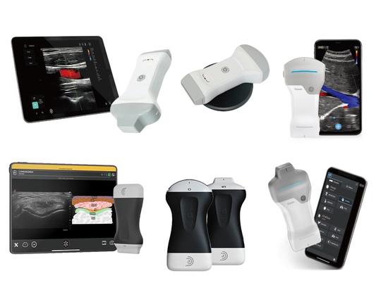 Guida all'acquisto delle sonde ecografiche wireless