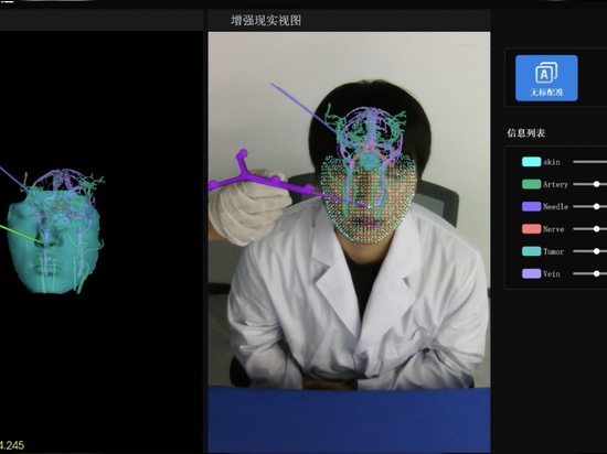 Ruitong SE: tracciamento 3D in tempo reale senza marcatori