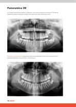 ORTHOPANTOMOGRAPH™ OP 3D™ - 10