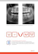 ORTHOPANTOMOGRAPH™ OP 3D™ - 11