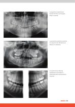 ORTHOPANTOMOGRAPH™ OP 3D™ Pro - 13