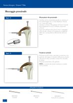 Dinamic T Tibia - 12