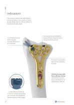 Wristar MultiAx - Distal radius sterile kit - 4