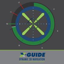 DYNAMIC 3D NAVIGATION FOR MORE ACCURATE IMPLANT SURGERY