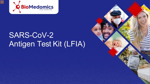 SARS-CoV-2-Rapid Antigen test