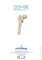 Ortholox UHMWPE Sistema di Cerchiaggio Ortopedico - 12