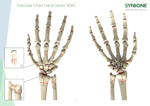 Fracture Charts Hand models 9061 series