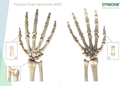 Fracture Charts Hand models 9063 series