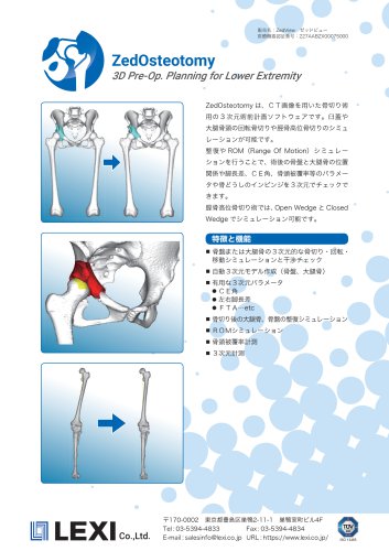 ZedOsteotomy