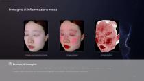 Analizzatore 3D della pelle - Sistema di valutazione della salute della pelle-5