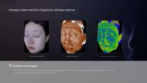 Analizzatore 3D della pelle - Sistema di valutazione della salute della pelle-6