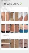 Cellusphere Roller-14