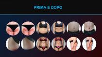 EMS Magshape con 4 maniglie-12