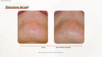 Epilazione DPL PLUS + Filtro DPL per la cura della pelle-14