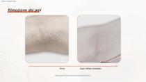 Epilazione DPL PLUS + Filtro DPL per la cura della pelle-15