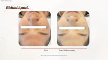 Epilazione DPL PLUS + Filtro DPL per la cura della pelle-16
