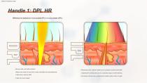 Epilazione DPL PLUS + Filtro DPL per la cura della pelle-4