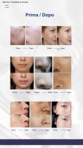 Hydrafacial portatile-7