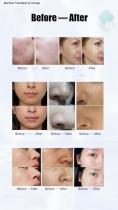 Hydrafacial Skinpro-3-8