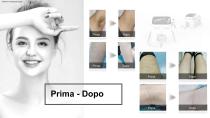 Laser a diodo portatile-18