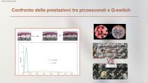 laser Nd:YAG a picosecondi SP-2 2000PS-5