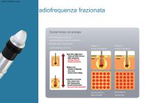Radiofrequenza a microaghi-10