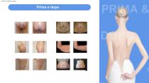 V-shaping-16