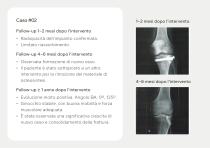 Innesti Ossei – Portfolio-10