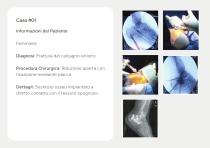 Innesti Ossei – Portfolio-7