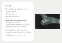 Innesti Ossei – Portfolio-8