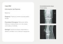 Innesti Ossei – Portfolio-9