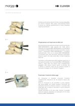 CERVICAL PEEK - 7