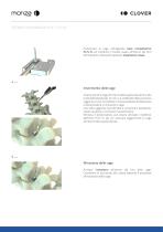 MONZA LUMBAR PLIF TLIF - 11