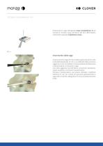 MONZA LUMBAR PLIF TLIF - 13