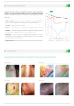 LASEmaR® 500-2