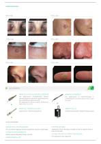 LASEmaR® 500-4