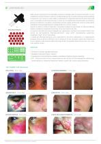 LASEmaR® 500-5