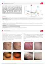 LASEmaR® 800-2