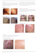 LASEmaR® 800-3